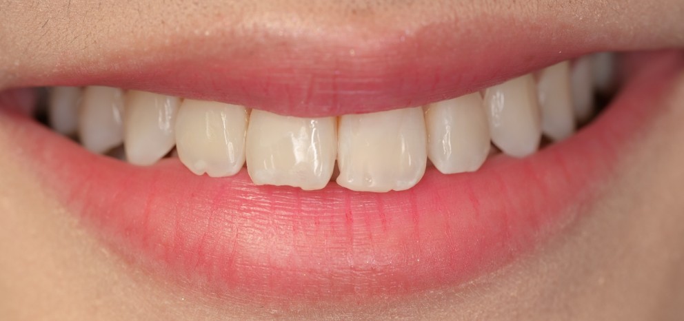 clinic case2.jpg